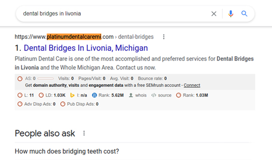 Dental Bridges Result Platinum Dental Caremi 